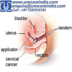 How to choose right and best surgeons in India