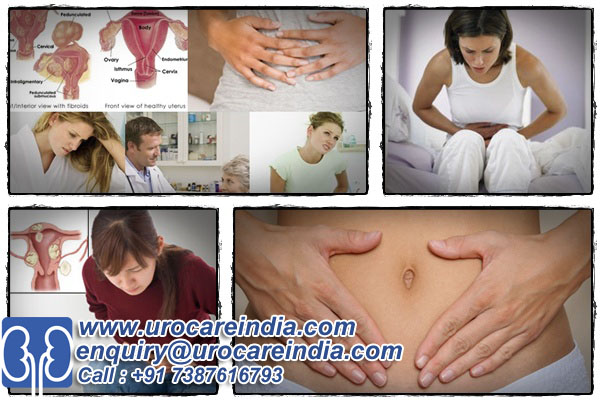 India is one stop destination for low cost fibroid surgery