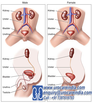Consults Reliable Urologist for Treatment of Kidney Stones or Enlarged Prostate Treatment
