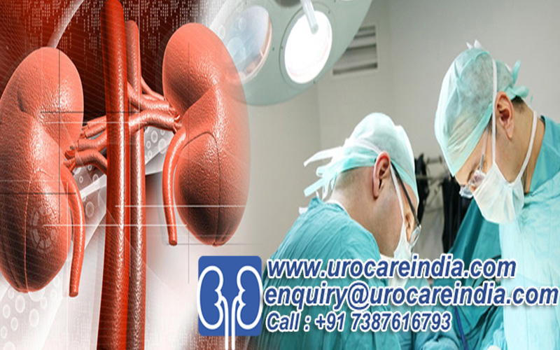 Kidney Transplant Surgery India At Low Cost – Kidney Transplant Cost