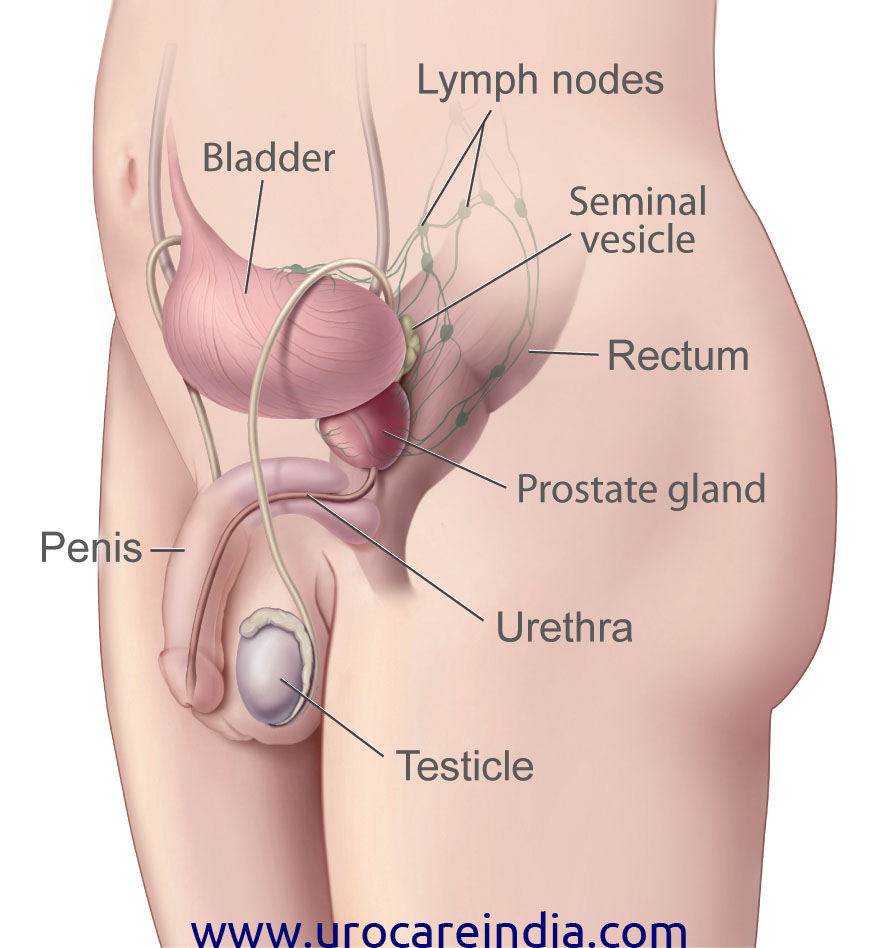 Remedies for Prostate Problems